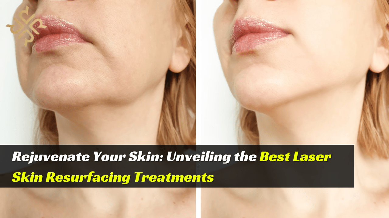 best laser treatment for skin resurfacing