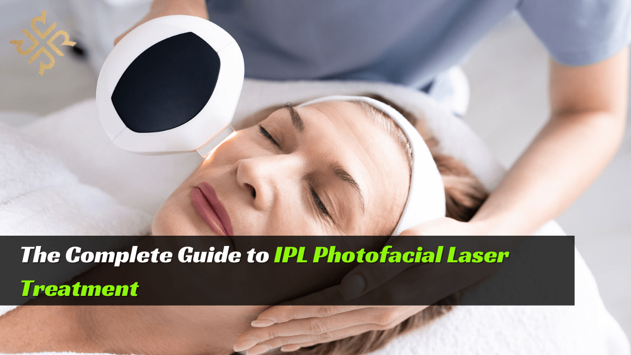 IPL Photofacial Laser Treatment