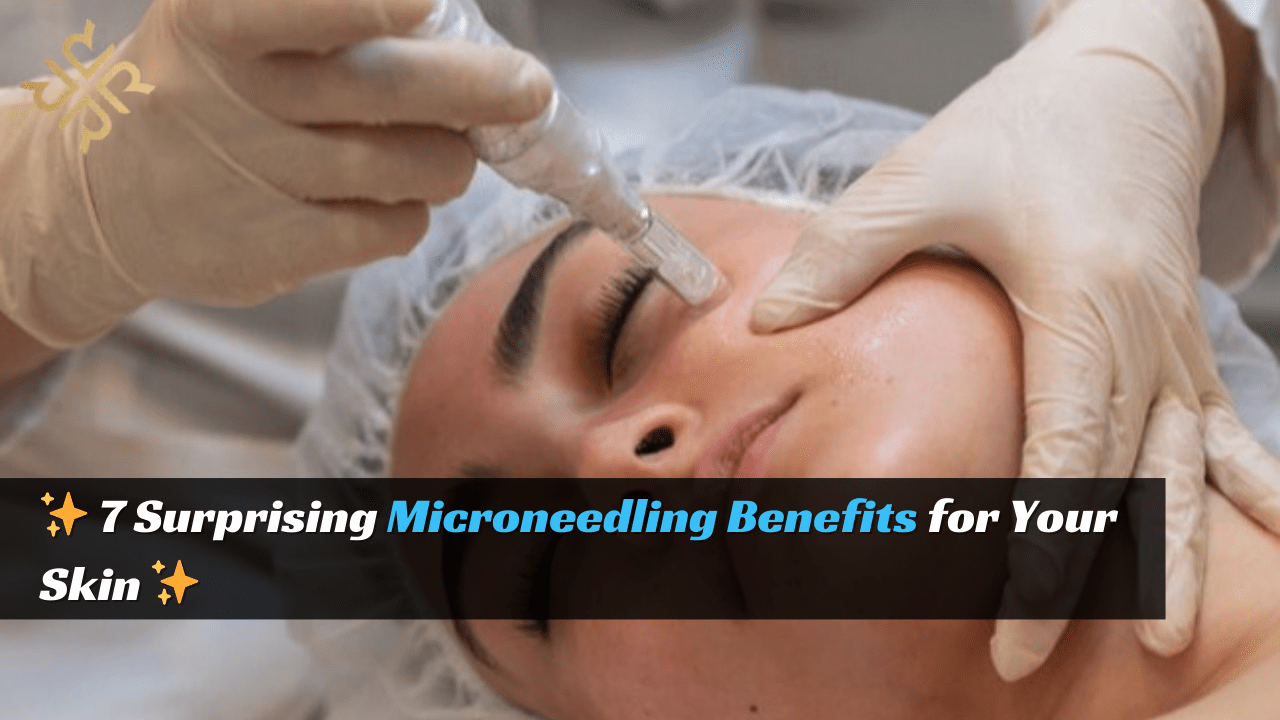 Microneedling Benefits