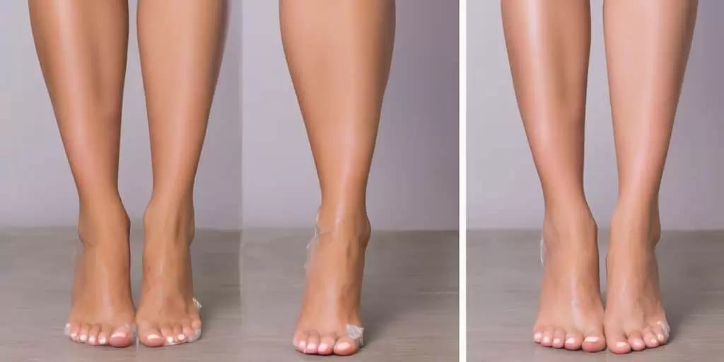 foot hair removal